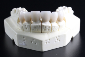 🦷 25 Shocking Meanings of a Teeth Falling Out Dream, teeth falling out